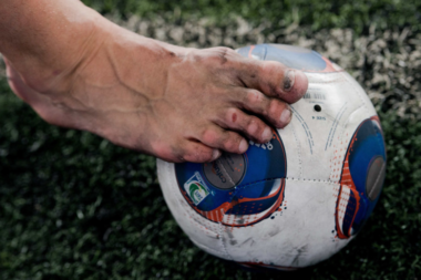 Soccer Player Toenails Injury : How To Prevent It